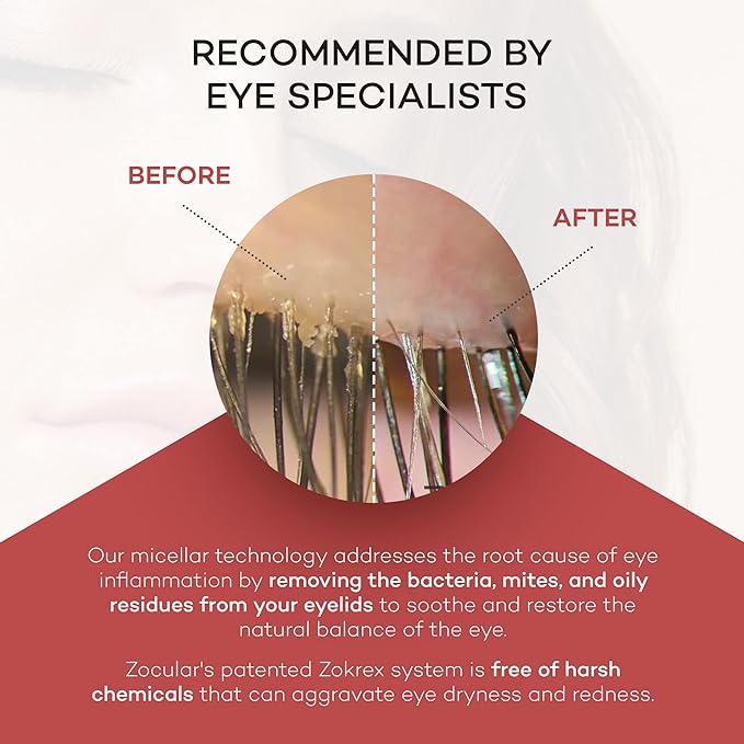 Zocular- Zocushield Gel